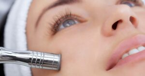 Microdermabrasion